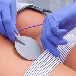 Миостимуляция: онлайн-курс с сертификатом. Теория и практика (фото)